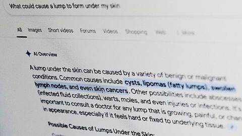 Una consulta relacionada con la salud en Google aparece en la pantalla de un ordenador en abril de 2025.